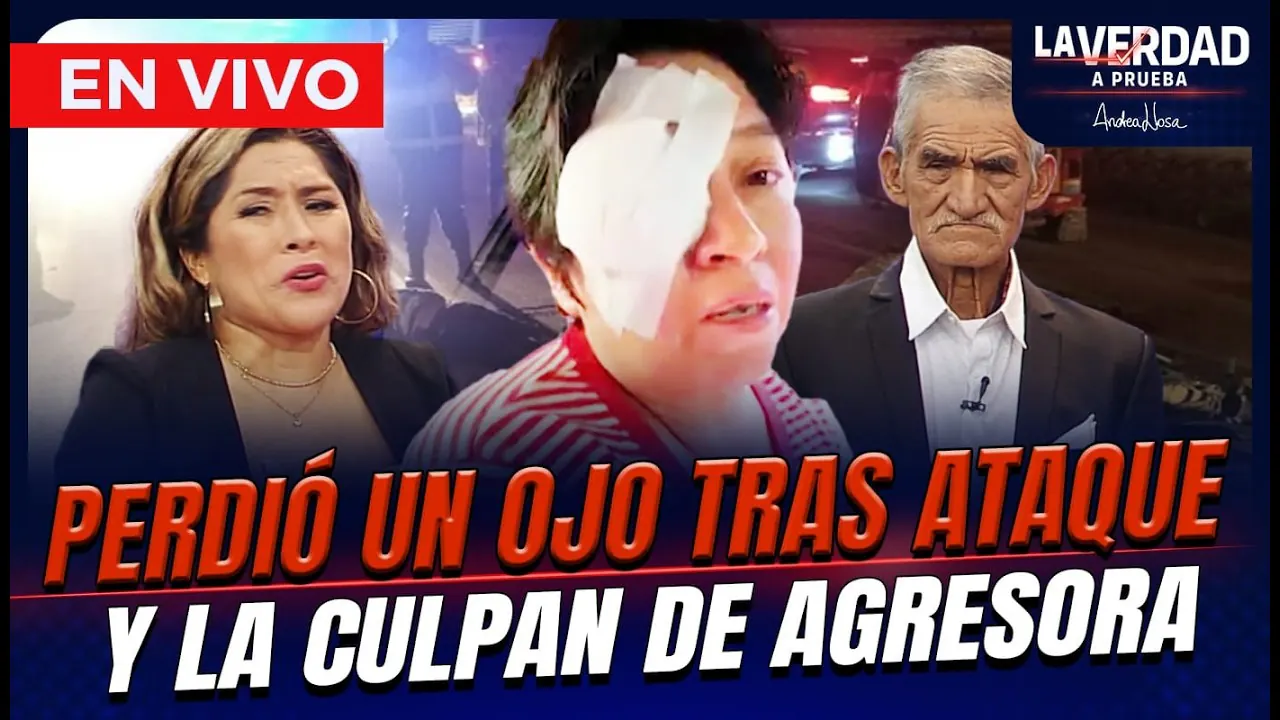 Reproducir: 🔴 EN VIVO – PERDIÓ UN OJO TRAS ATAQUE Y LA CULPAN DE AGRESORA 😱💔 LA VERDAD A PRUEBA POR PANAMERICANA