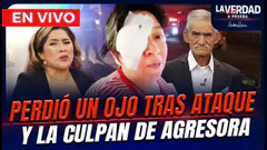 EN VIVO – PERDIÓ UN OJO TRAS ATAQUE Y LA CULPAN DE AGRESORA LA VERDAD A PRUEBA POR PANAMERICANA