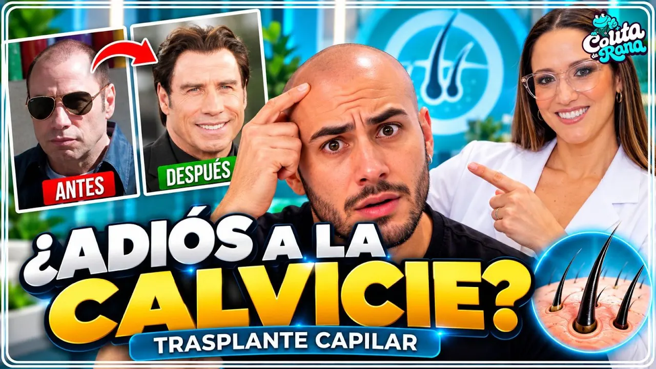 Reproducir: COLITA DE RANA🐸🩺 :¿EL TRASPLANTE CAPILAR REALMENTE FUNCIONA? 😱 NOS VISITA EL DR. LIRA