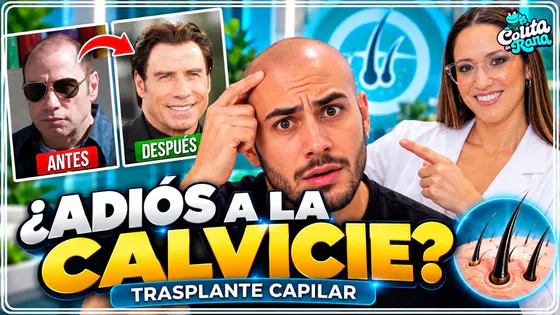 COLITA DE RANA :¿EL TRASPLANTE CAPILAR REALMENTE FUNCIONA? NOS VISITA EL DR. LIRA