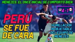 EEUU NOS GOLEÓ POR PRIMERA VEZ / RIVALES PUSIERON A UN CHICO DE 16 AÑOS /