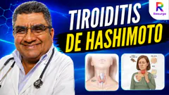 TIROIDITIS DE HASHIMOTO | DR. OLAYA RESPONDE - 03 DE SEPTIEMBRE