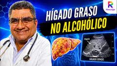 HÍGADO GRASO NO ALCOHÓLICO | DR. OLAYA RESPONDE - 07 DE SEPTIEMBRE
