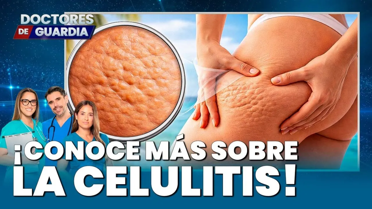 Reproducir: 🔴 EN VIVO | ¡CONOCE MÁS SOBRE LA CELULITIS! – Doctores de Guardia, 17 de marzo
