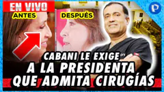 ¿Dina Boluarte admitirá cirugías estéticas tras carta notarial de Mario Cabani? | #Panamericana