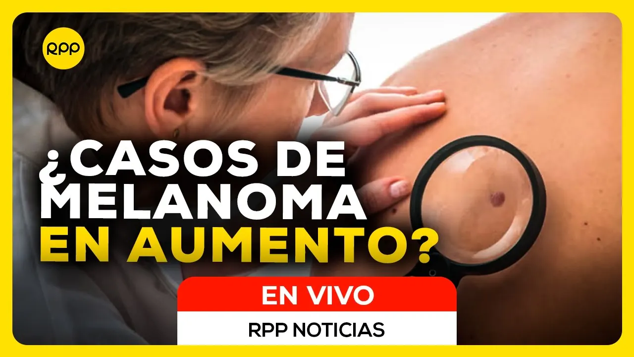 Reproducir: EN VIVO  🔴 MELANOMA EN PERÚ: ¿ESTÁ AUMENTANDO EL CÁNCER DE PIEL MÁS MALIGNO? | RPP Noticias