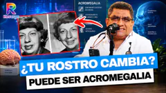 ACROMEGALIA: LA PELIGROSA ENFERMEDAD POR EXCESO DE HORMONA DE CRECIMIENTO | DR. OLAYA RESPONDE